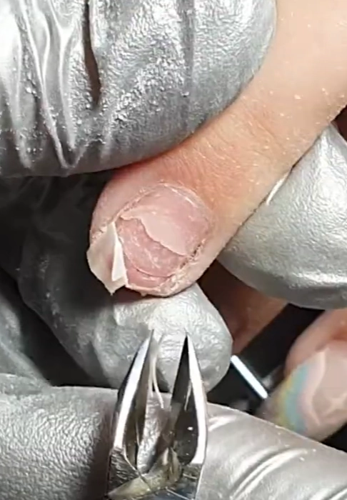 Ломкие ногти